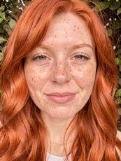 Beautiful Redheads With Freckles