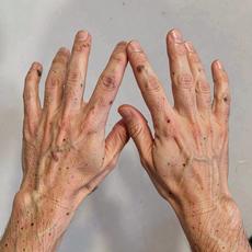 Boney Hands