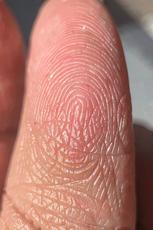 Finger Texture