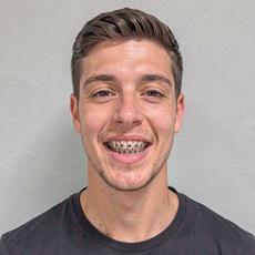 Man With Braces