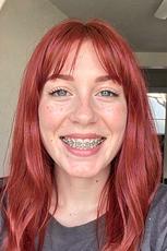 Red Head With Braces