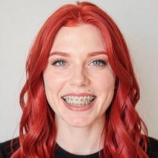 Redhead Braces