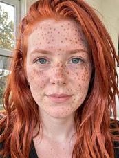 Redhead With Freckles